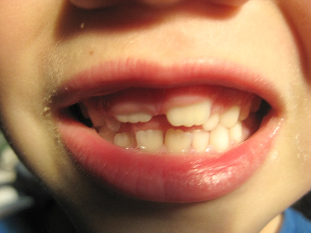 Eero's mouth